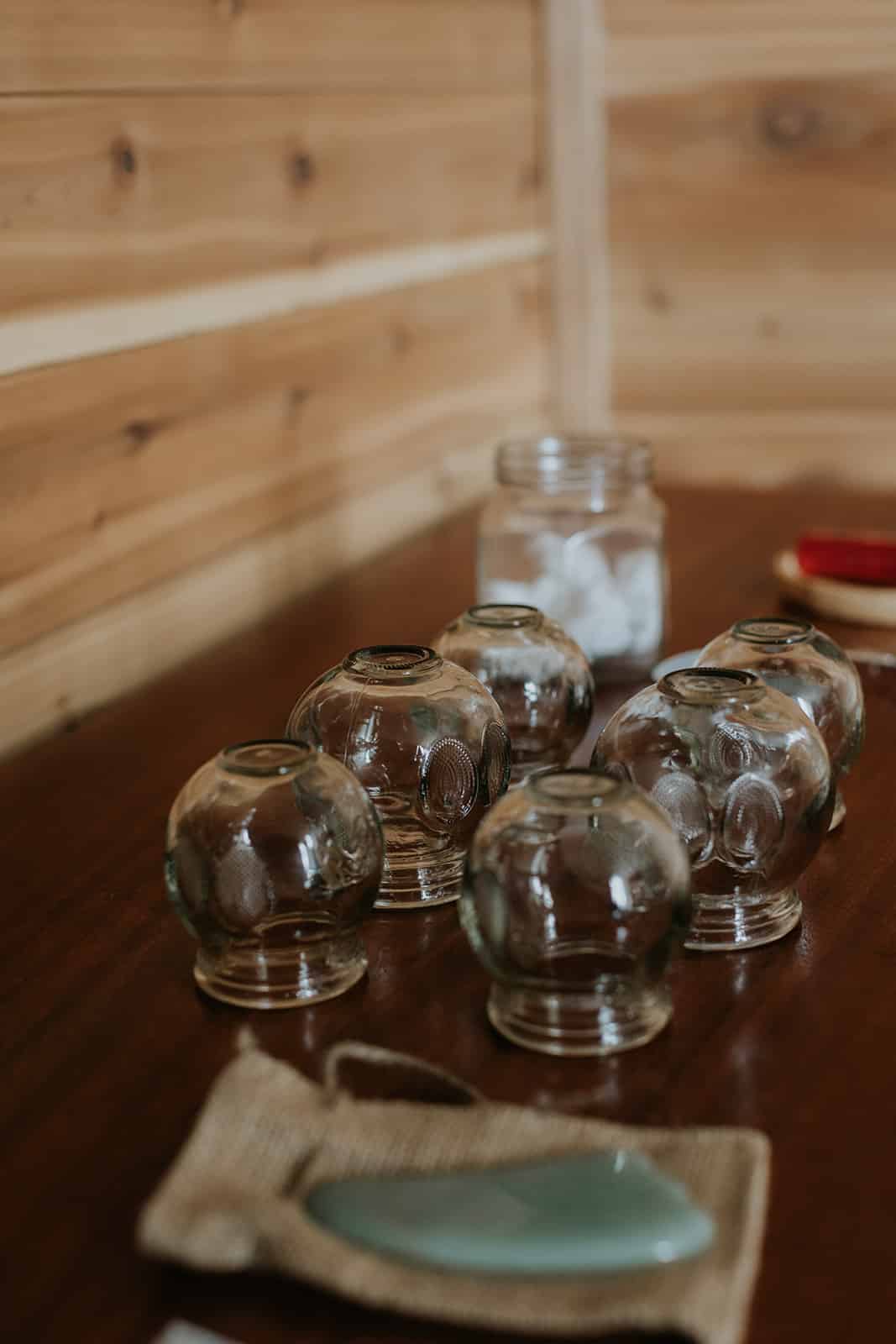 Traditional cupping therapy cups arranged for an acupuncture session