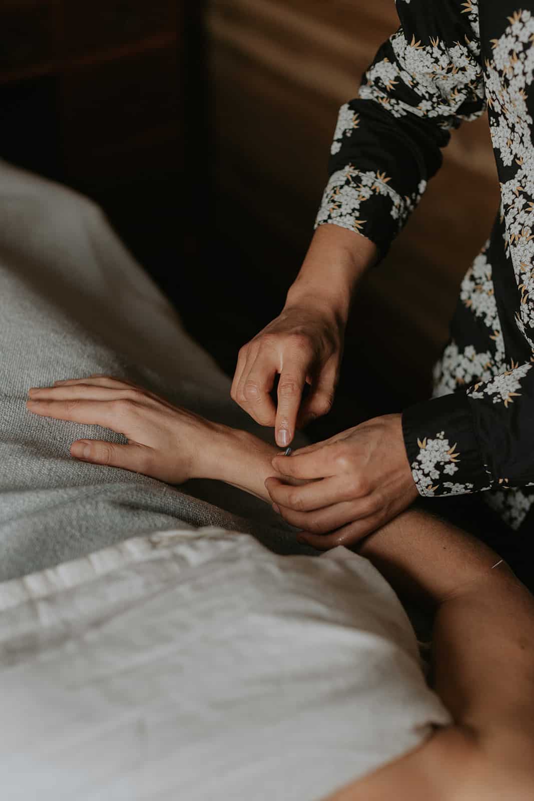 Acupuncture needles inserted along the arm's meridian points to enhance fertility, illustrating TCM's holistic healing approach.