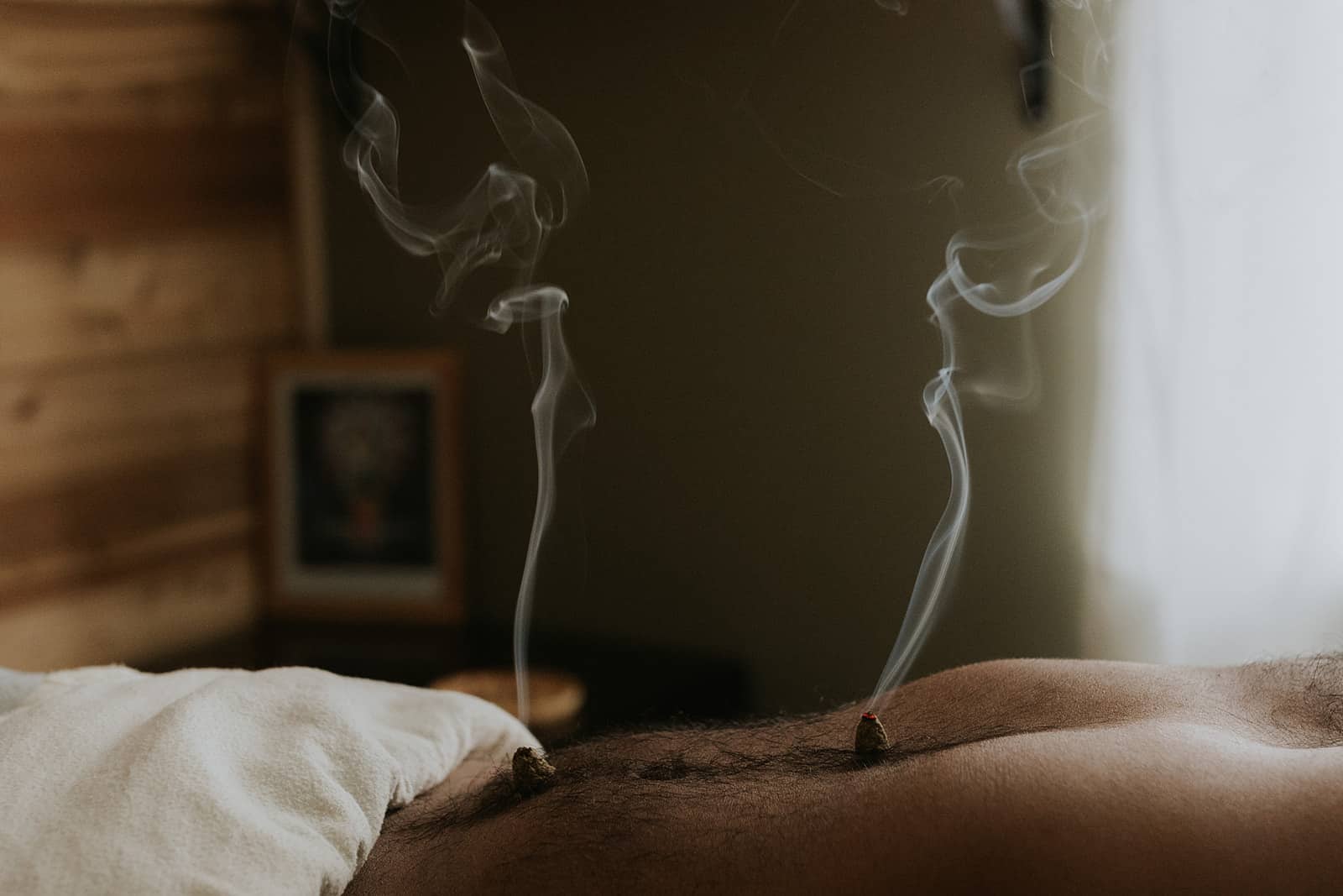 Moxibustion therapy being applied on a patient's stomach by a professional acupuncturist in Victoria.